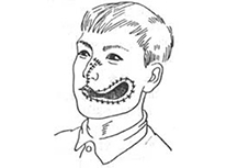 口腔頜面部創(chuàng)傷