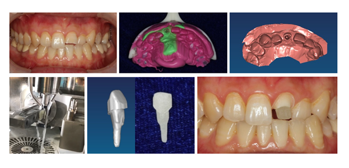 鄧旭亮課題組科研成果成功取得國家藥監(jiān)局Ⅲ類產(chǎn)品注冊證