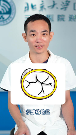 窩溝封閉有必要做嗎？